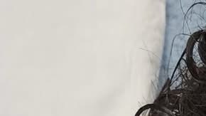 El joven “J.R.” muestra las lesiones en su rostro que, alega una demanda, sufrió a manos de policías de Rockford, IL. (Cortesía Loevy+Loevy)