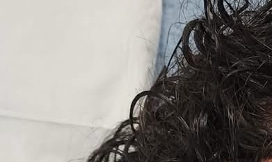 El joven “J.R.” muestra las lesiones en su rostro que, alega una demanda, sufrió a manos de policías de Rockford, IL. (Cortesía Loevy+Loevy)