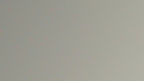 El Dr. Vitor Mendes Pereira opera un derrame cerebral a distancia desde la sala de control de la Clínica Norte en Santiago de Panamá con el sistema XCath Iris