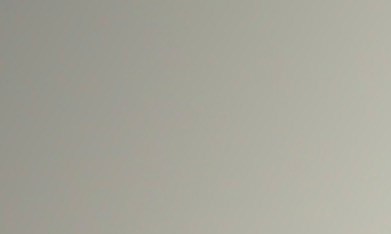 El Dr. Vitor Mendes Pereira opera un derrame cerebral a distancia desde la sala de control de la Clínica Norte en Santiago de Panamá con el sistema XCath Iris