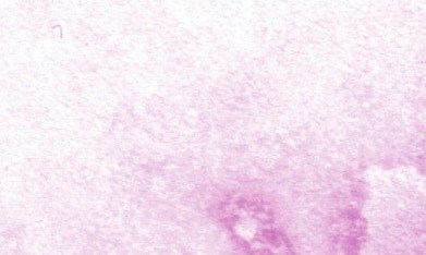 Una imagen de microscopio del virus del ébola. (CDC/AP)