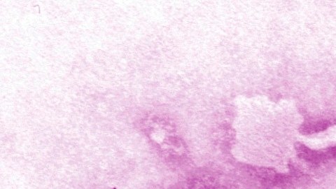 Una imagen de microscopio del virus del ébola. (CDC/AP)